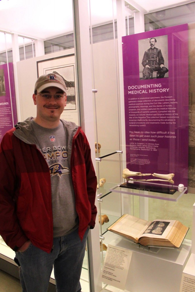 Posing with General Sickles' leg